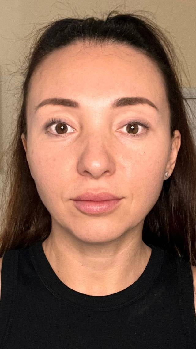Before and after comparison of a woman's face with a neutral background, facebliss